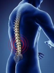 Back Pain is a top reason for patients to visit their doctors each year